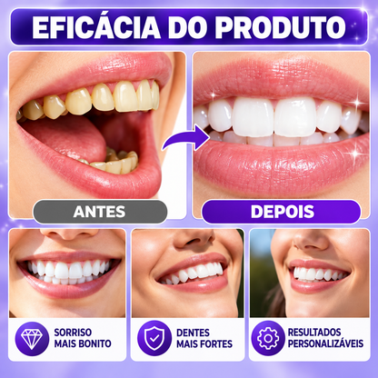 Tiras Clareadoras — Branqueamento Dentário, Tratamento de Manchas e Correção da Cor